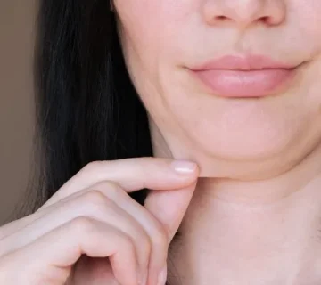 غبغب، رفع غبغب، لاغری غبغب