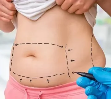لاغری موضعی، دستگاه لاغری، چربیسوزی موضعی، لاغری موضعی شکم