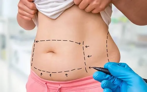 لاغری موضعی، دستگاه لاغری، چربیسوزی موضعی، لاغری موضعی شکم